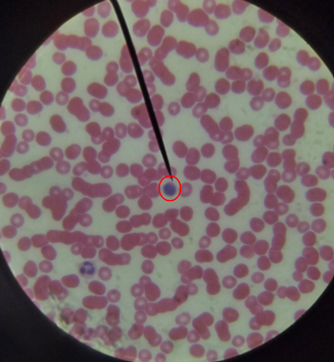 <ol><li><p>What cell is the red circle pointing to?</p></li><li><p>What specific feature can be used to identify these cells?</p></li></ol><p></p>