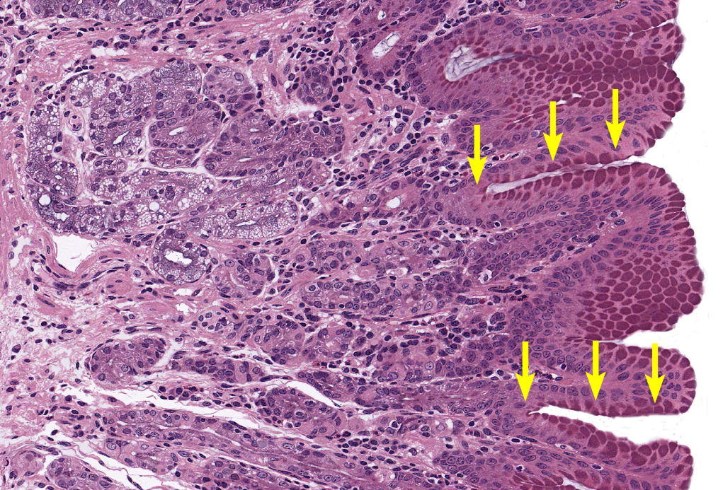 <p>Stomach</p><p><strong>NOTICE: THE DEEP GASTRIC PITS WITH DARK STAINED GASTRIC GLANDS AROUND THEM AND NOT MANY GOBLET CELLS</strong></p>