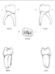 <p>- crowns unlike any other primary or permanent tooth</p><p>- wider MD than BL</p><p>- 2 buccal cusps (M larger than D)</p><p>- 2 lingual cusps (M larger than D)</p><p>- bulbous curvature on buccal surface in cervical 3rd with narrow occlusal table</p><p>- central and mesial pits</p><p>- transverse ridge</p>
