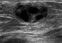 <p>Identify this image. </p>