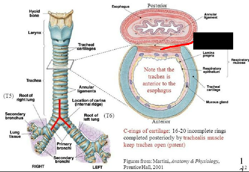 <p><span style="background-color: transparent;">&nbsp;A muscle that is located at the posterior section of the trachea. It can constrict and contract the trachea. It usually ends at about the level of the fifth thoracic segment.</span></p>
