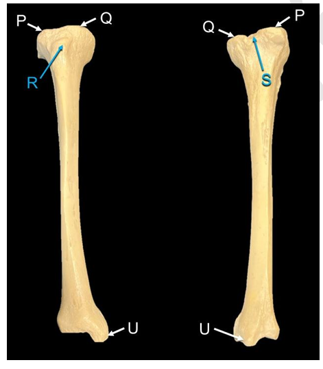 <p>Label P, Q, R, S, U.</p>