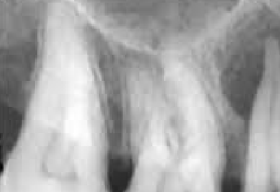 <p>Radiolucent Film Images</p>