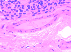 <p>What type of artery is shown?</p>