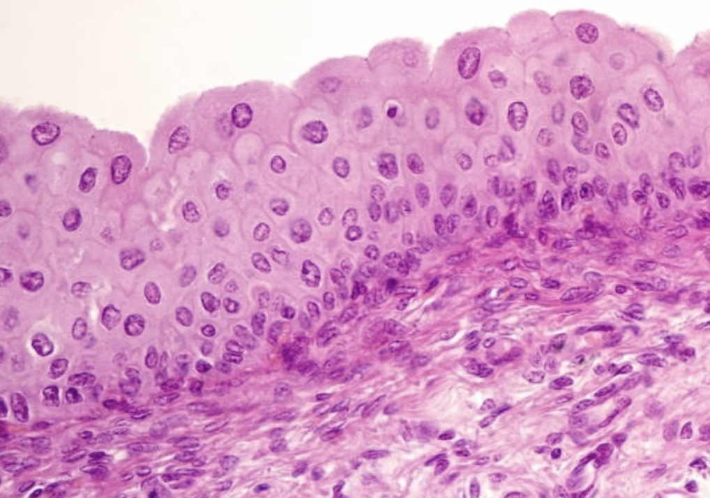 <p>name the epithelium & give example </p>