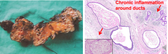 <p>What pathology?</p>