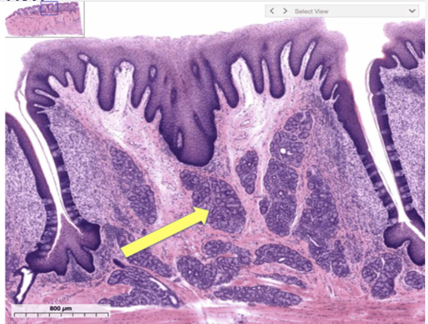 <p>Identify the following structure in the tongue</p>