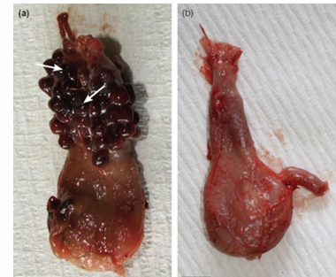 <p>after copulation, female swells and become almost spherical</p>