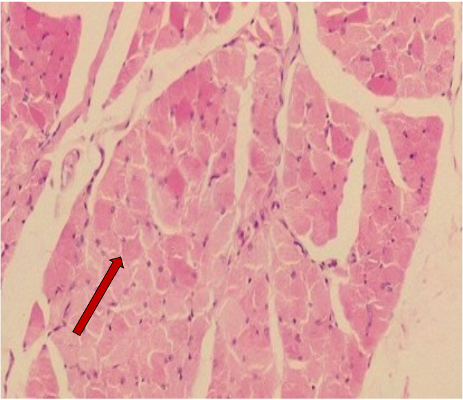 <p>connective tissue that surrounds each muscle fiber</p>