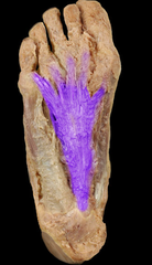 <p>sole of foot</p>