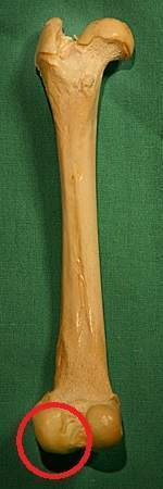 <p>Condyle </p>
