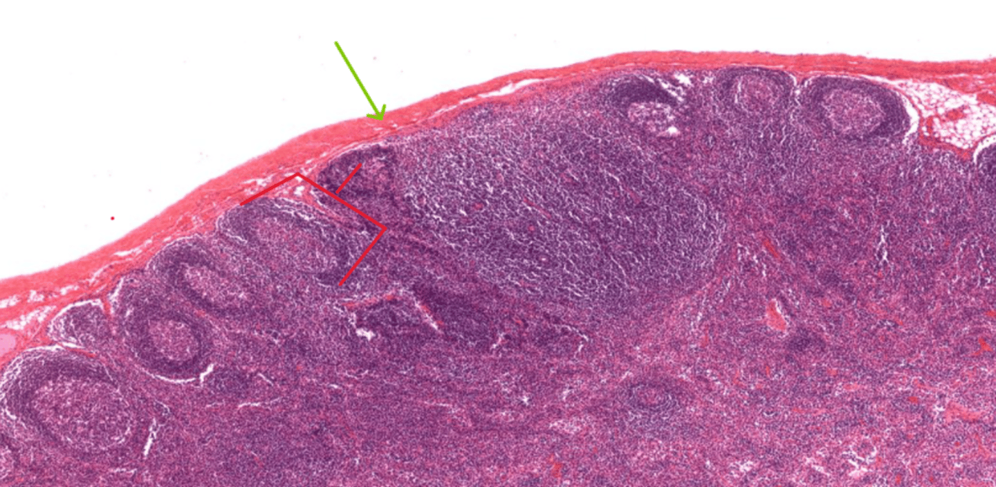 <p>What specific part of the lymph node is the lymphoid follicle (Red bracket) in?</p>