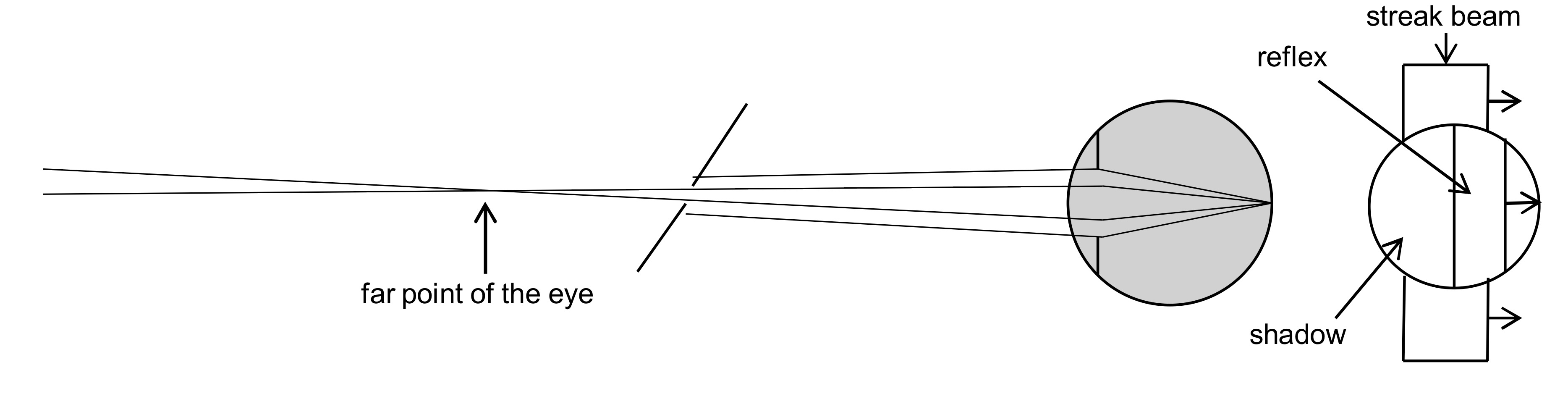 <p>far point of eye is behind viewing aperture (between aperture and infinity)</p><p>add + lenses</p><p>hyperopes, emmetropes, low myopes</p>