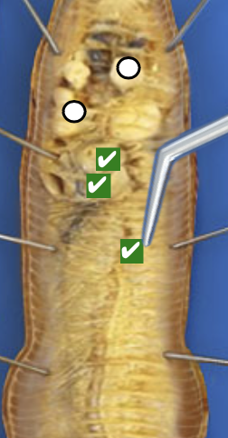 <p>What structure is this pointing to?</p>
