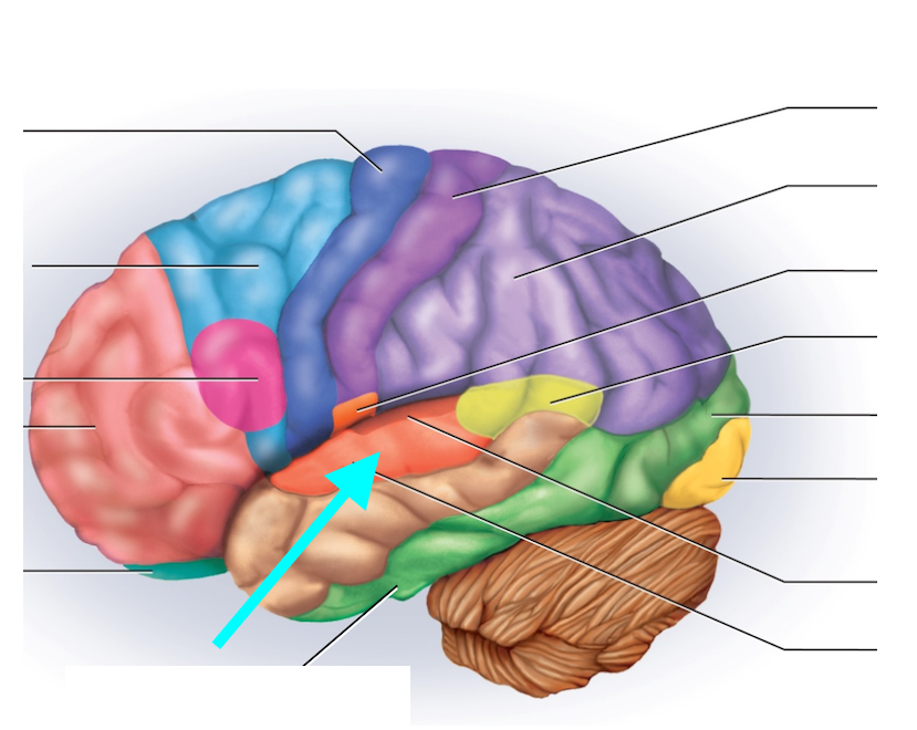 term image