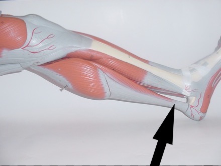 <p>what muscle is this?</p>