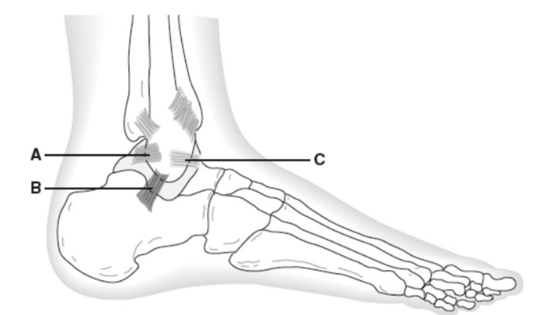<p>C</p>