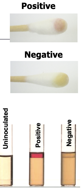 <p>Purpose: used to evaluate Gram- bacilli (must perform on bacteria grown on tryptohan-containing media such as BAP)</p><p></p><p>Principle: detects tryptophanase, which breaks down tryptophan (amino acid) to release indole. Indole combines with Kovac’s reagent (acid pH) to create red compound.</p><p>Kovac’s reagent: para-dimethylamino-benzaldehyde</p><p></p><p>Procedure: inoculate tryptophan containing broth with organism and incubate. Add Kovac’s reagent and observe for red ring at the top of broth. Or inoculate a sterile swab with organism and add a drop of Kovac’s reagent. </p>