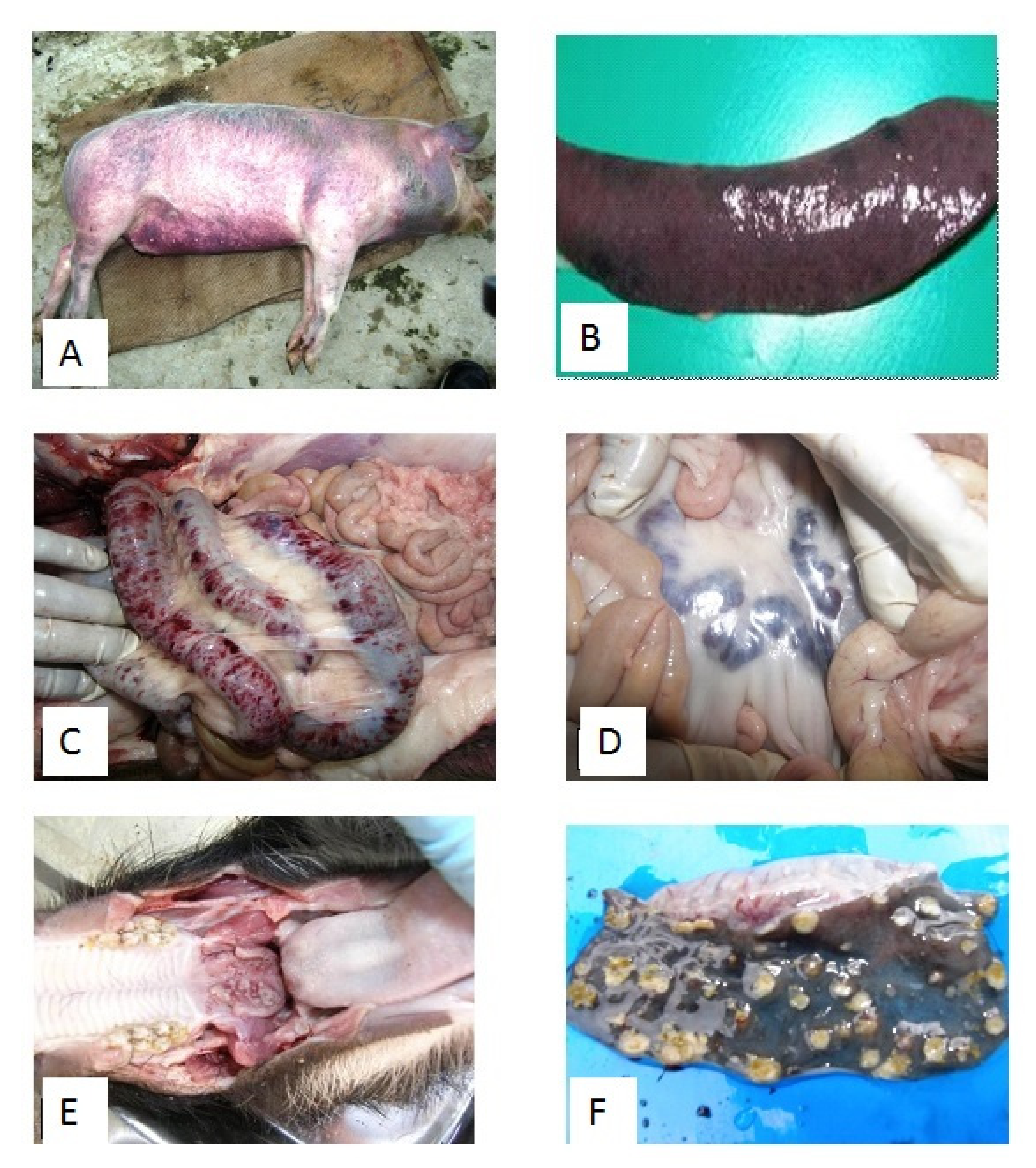 <p>CSF Gastrointestinal Progression</p>