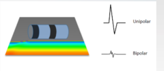 <p>- EGMs diminish in amplitude when catheter perpendicular to wavefront</p>