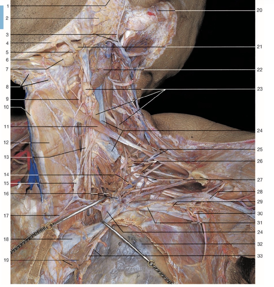 <p>Pinche 28</p>