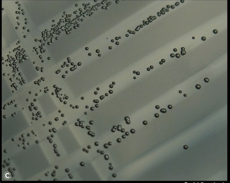 <p>what bacteria is describe below:</p><ul><li><p>tiny, glistening, compact</p><ul><li><p><strong>bisected pearls</strong></p></li><li><p><strong>mercury drops </strong>(silver colored)</p></li></ul></li><li><p>may be beta-hemolytic on BG agar</p></li></ul><p></p>
