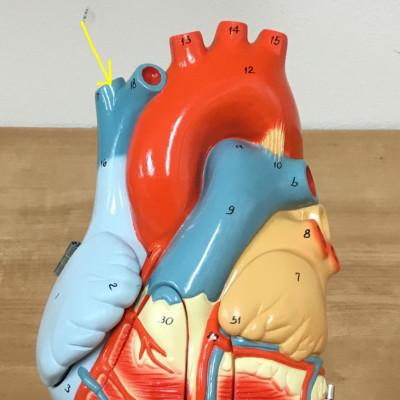 <p>name this vein </p>