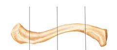 <p>Name the directional term that is perpendicular to the long axis of an elongated structure?</p>