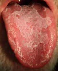 <p>What is the possible cause of this lesion?</p>