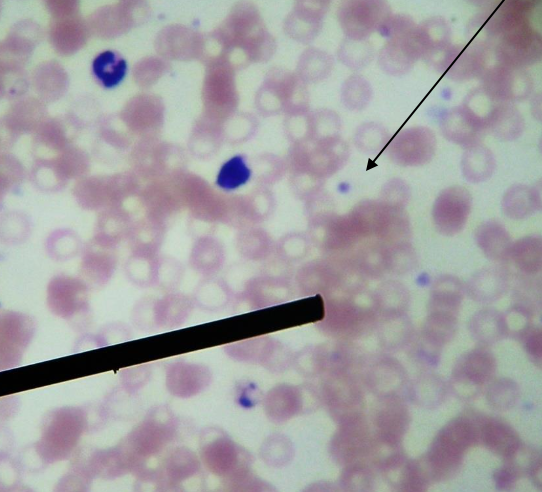 <p>What phylum does <u>Plasmodium</u> belong to?</p>