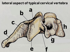 <p>label (a-d) lateral aspect of typical cervical vertebra</p>