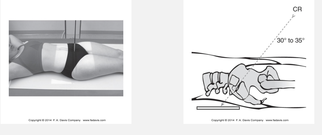<p>What is visualized on an AP axial/sacroiliac radiograph?</p>