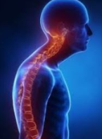 <p><span style="background-color: transparent;"><strong><span>The patient below has</span></strong></span></p><p><span style="background-color: transparent;"><span>Scoliosis</span></span></p><p><span><span>Kyphosis</span></span></p><p><span style="background-color: transparent;"><span>Lordosis</span></span></p>