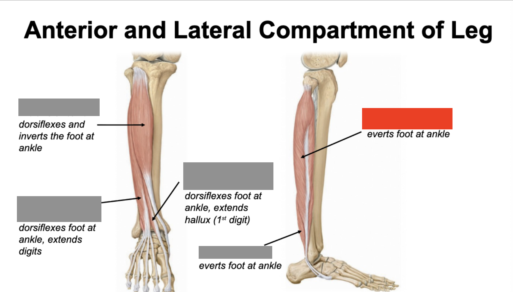 <p>everts foot at ankle</p>