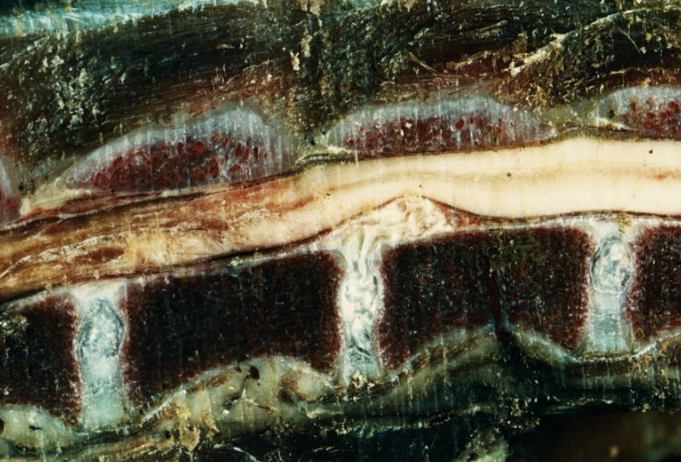 <p><span><strong>Vid obduktion av en tax som visat paralys av bakbenen och smärta från ländryggen, påvisas en förändring i</strong></span></p><p class="MsoNormal"><span><strong>ländryggen, som benämns Hansen typ I (se bilden nedan).</strong></span></p><p class="MsoNormal"><span><strong>Vilka patologiska förändringar ser du i följande vävnader? (2p)</strong></span></p><p class="MsoNormal"><span><strong>a) Makroskopiskt</strong> i intervertebraldisken. <strong>(1p)</strong></span></p>