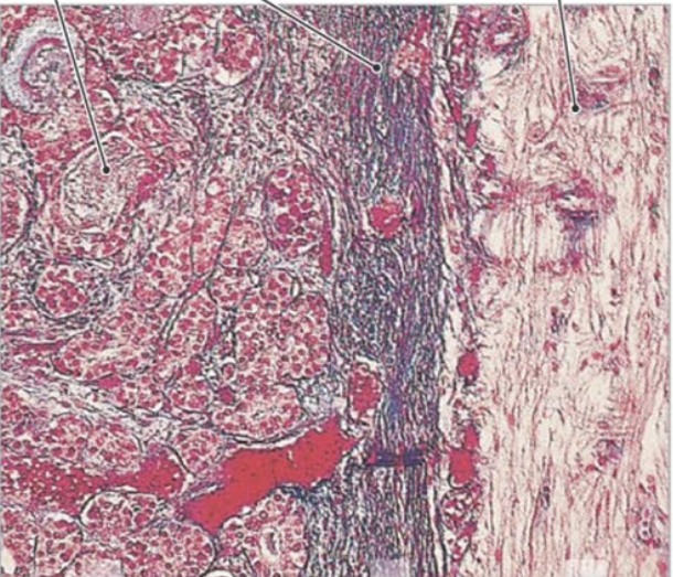 <p>lobes right to left</p>