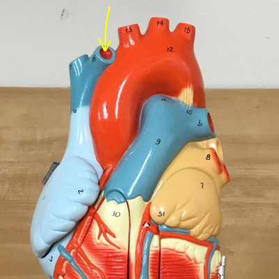 <p>name this vein </p>