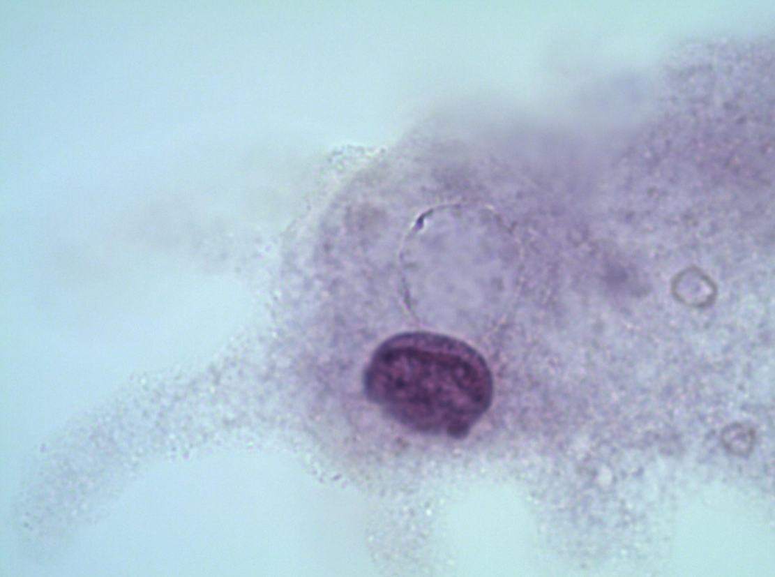 <p>*note nucleus, pseudopodia </p>