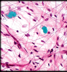 <p>Identify the highlighted structure</p>