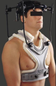 <p>Halo Vest</p>