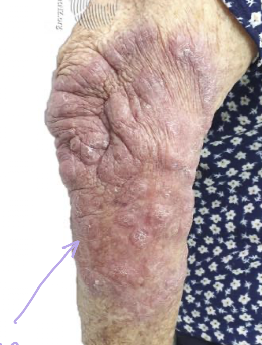 <p>What condition is this?</p>
