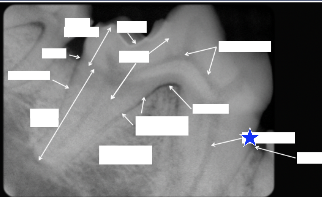 <p>What part of the tooth is indicated by the star?</p>