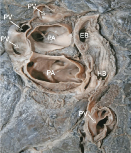 <p>Which lung is this?</p>