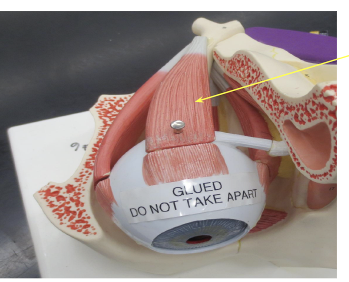 <p>What Muscle is this?</p>
