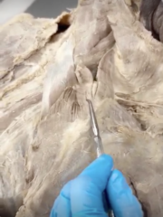 <p>Name the Muscle</p>