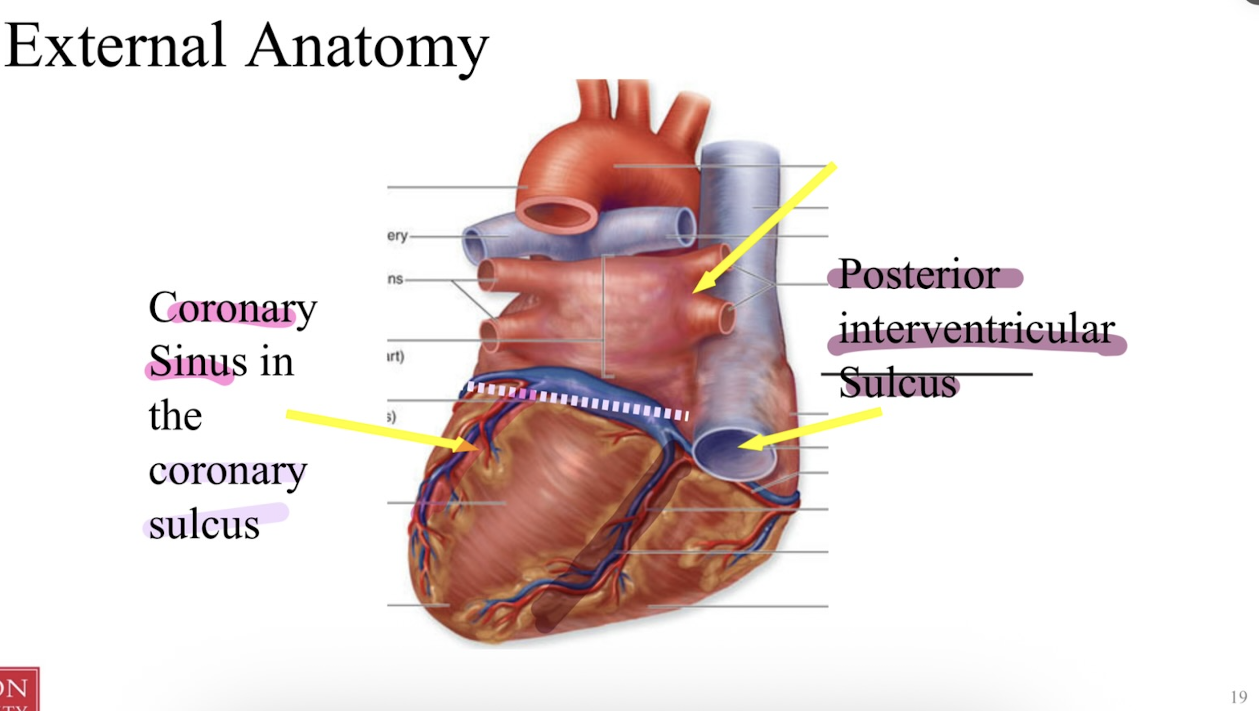 <p>coronary sinus inside the coronary sulcus </p>