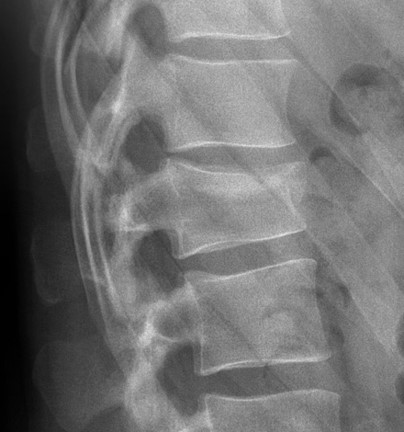 <p>What is the Dx, is it stable or unstable, and is it new or old?</p>