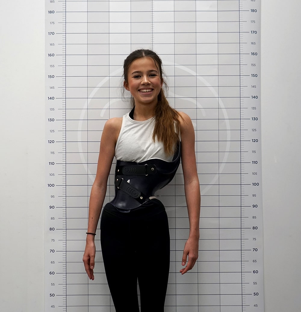 <ol><li><p>asymmetry in <span style="color: rgb(226, 109, 109);"><strong>scapula, ribs, flanks, shoulder, hips</strong></span></p></li><li><p><span style="color: rgb(156, 58, 198);"><strong>bad fitting clothes</strong></span><span style="color: rgb(9, 7, 10);"> (one leg shorter than other)</span></p></li><li><p><span style="color: rgb(47, 181, 104);">more common in <strong>females (8-15 y/o)</strong></span></p></li></ol><p></p>