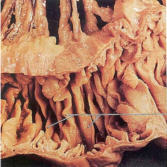 <ul><li><p>Where final chemical digestion and most absorption of nutrients occurs</p></li><li><p>Deep plicae and villi</p></li></ul><p></p>