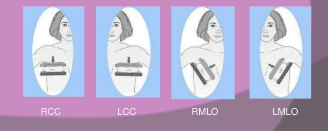 <p>mammography views</p>